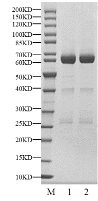PRKACA(PKACα) GST Tag Protein, Human