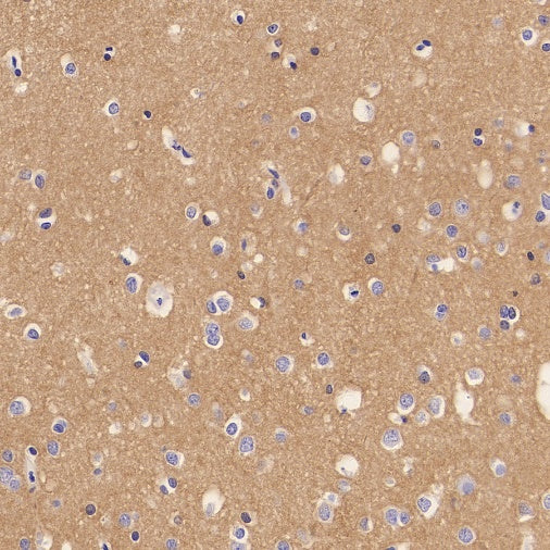 LICAM Recombinant Rabbit mAb (SDT-2594-39)
