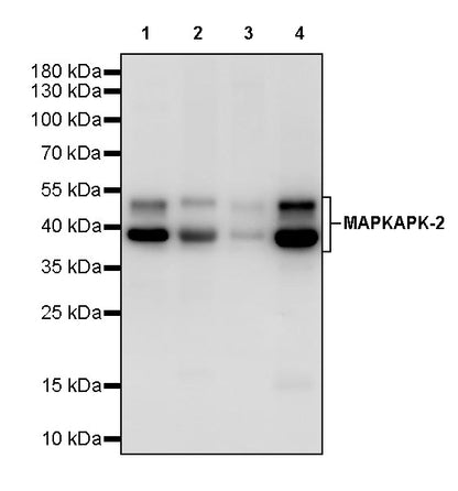 MAPKAPK-2 Recombinant Rabbit mAb (S-2641-58)