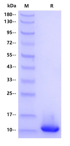 Mouse Complement C3a Protein, His Tag