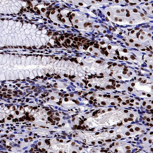 HAT1 Recombinant Rabbit mAb (S-2429-14)