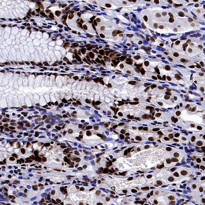 HAT1 Recombinant Rabbit mAb (S-2429-14)