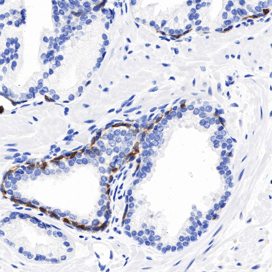 S-RMab® CK5/6 Recombinant Rabbit mAb,PBS Only (SDT-P004)