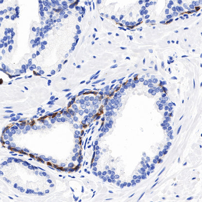S-RMab® CK5/6 Recombinant Rabbit mAb,PBS Only (SDT-P004)