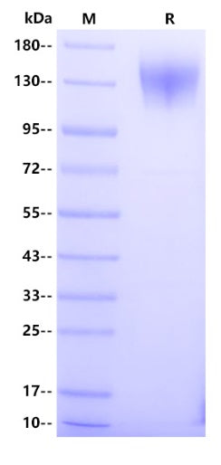 Human OSMR Protein, His Tag