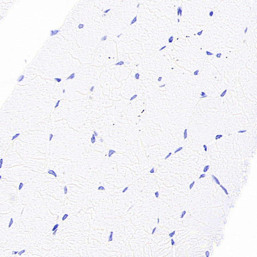 SPTLC1 Recombinant Rabbit mAb (S-6028)