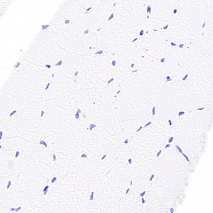 SPTLC1 Recombinant Rabbit mAb (S-6028)