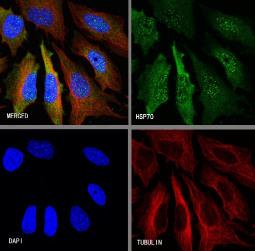 HSP70 Recombinant Rabbit mAb (S-992-39)