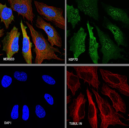 HSP70 Recombinant Rabbit mAb (S-992-39)