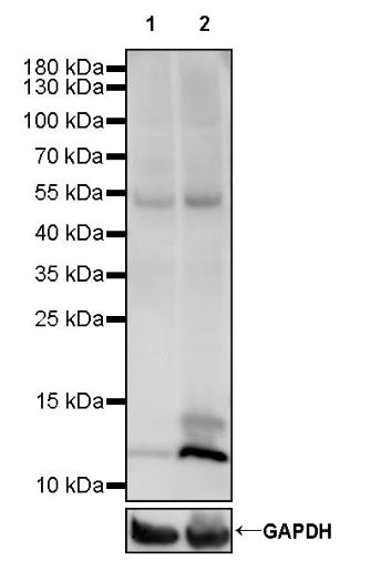 Butyryllysine Rabbit mAb (S-R399)