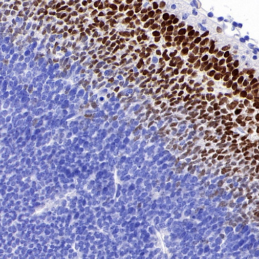 TBR1 Recombinant Rabbit mAb (S-1102-34)