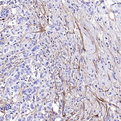 Collagen III Recombinant Mouse mAb (S-3838)