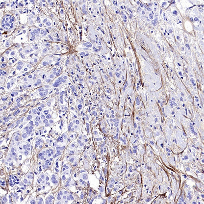 Collagen III Recombinant Mouse mAb (S-3838)