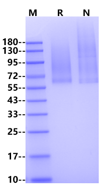 Glypican 1/GPC1 His Tag Protein, Human