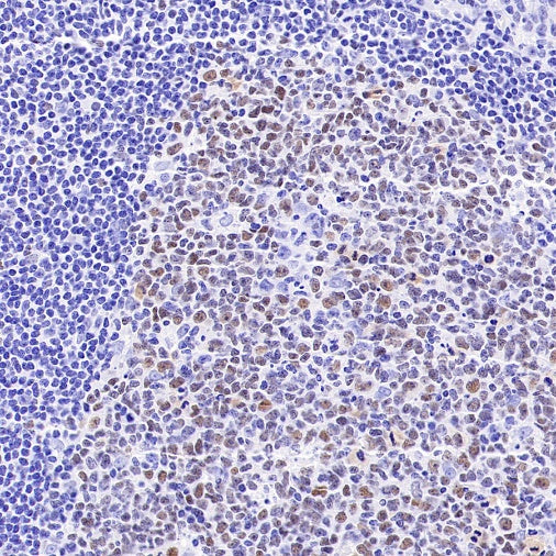 BCL-6 Recombinant Mouse mAb (S-R634)