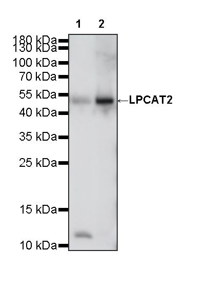 LPCAT2 Recombinant Rabbit mAb (S-4239-18)