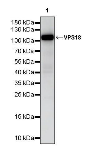 VPS18 Recombinant Rabbit mAb (S-2517-23)