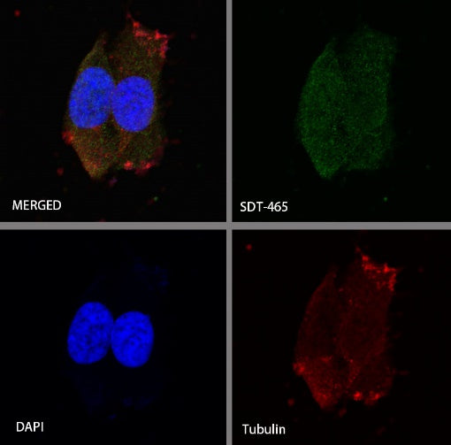 FoxO3a Recombinant Rabbit mAb (S-465-41)