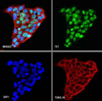 TKT Rabbit Polyclonal Antibody