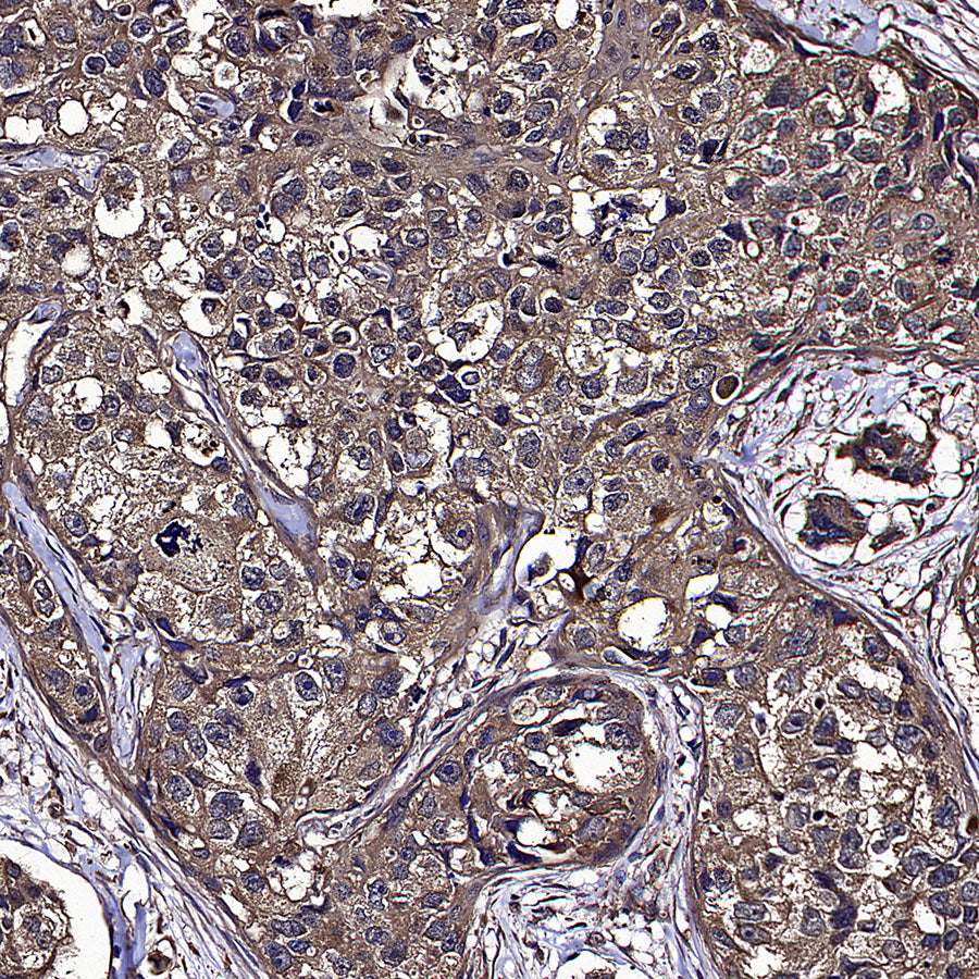 SREBF1 Mouse mAb