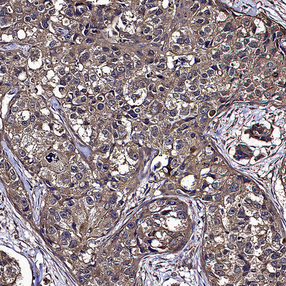 SREBF1 Mouse mAb
