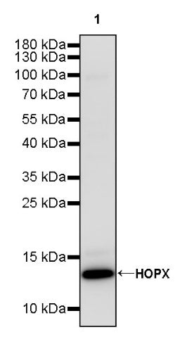 HOPX Recombinant Rabbit mAb (S-2087-269)