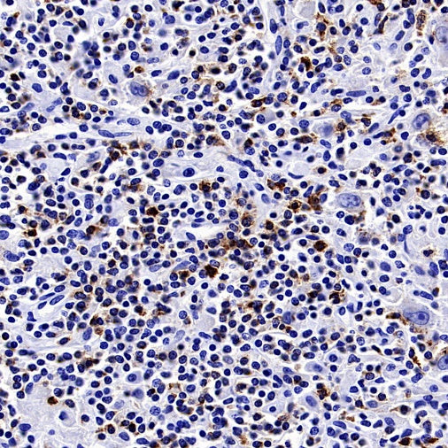 CTLA4 Recombinant Rabbit mAb (SDT-3348)