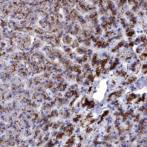 Cathepsin D Recombinant Rabbit mAb (S-R208)