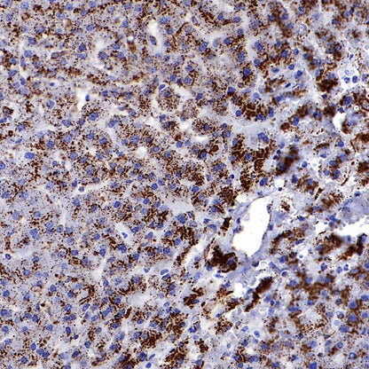 Cathepsin D Recombinant Rabbit mAb (S-R208)