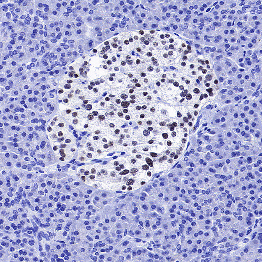 NeuroD1 Recombinant Rabbit mAb (SDT-3843-59)