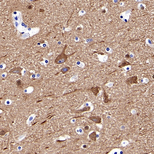 α-tubulin Recombinant Mouse mAb (S-364-23HL)