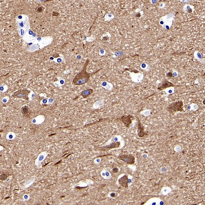 α-tubulin Recombinant Mouse mAb (S-364-23HL)
