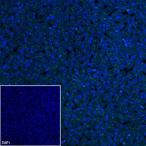 MDR3 Recombinant Rabbit mAb (SDT-1949-60)