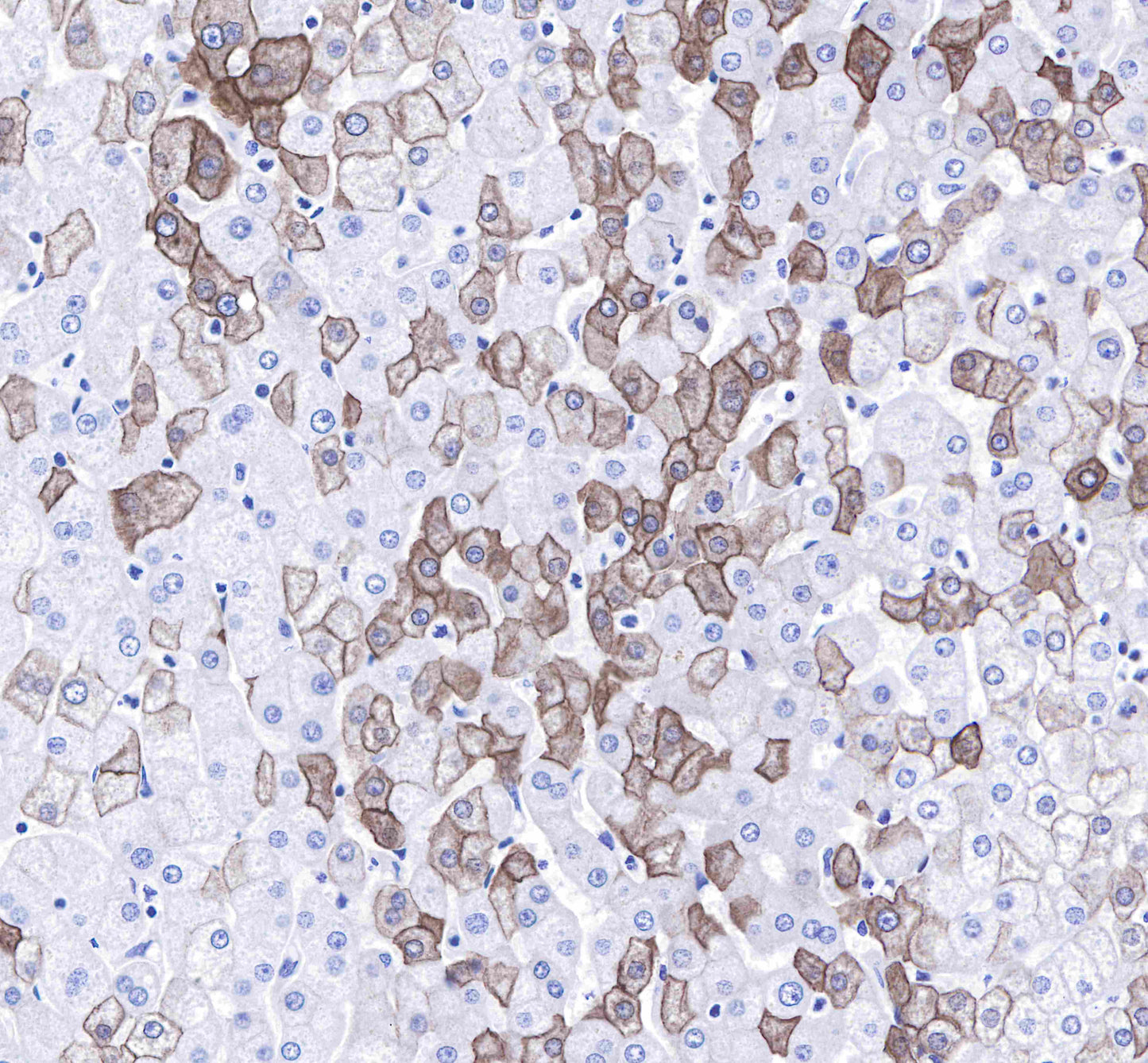 Keratin 8 Recombinant Rabbit mAb,PBS Only (SDT-016-46)
