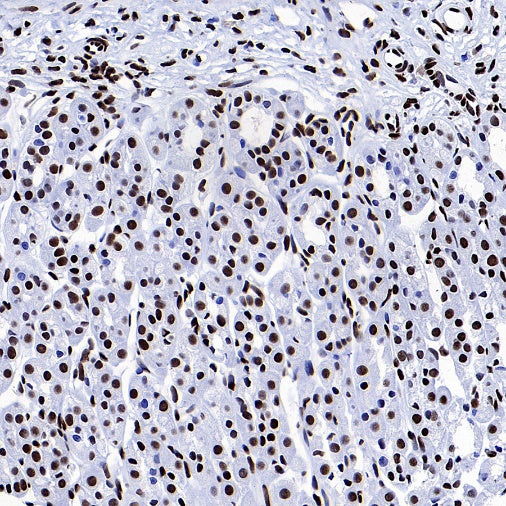 FUS Recombinant Rabbit mAb (S-1015-21)