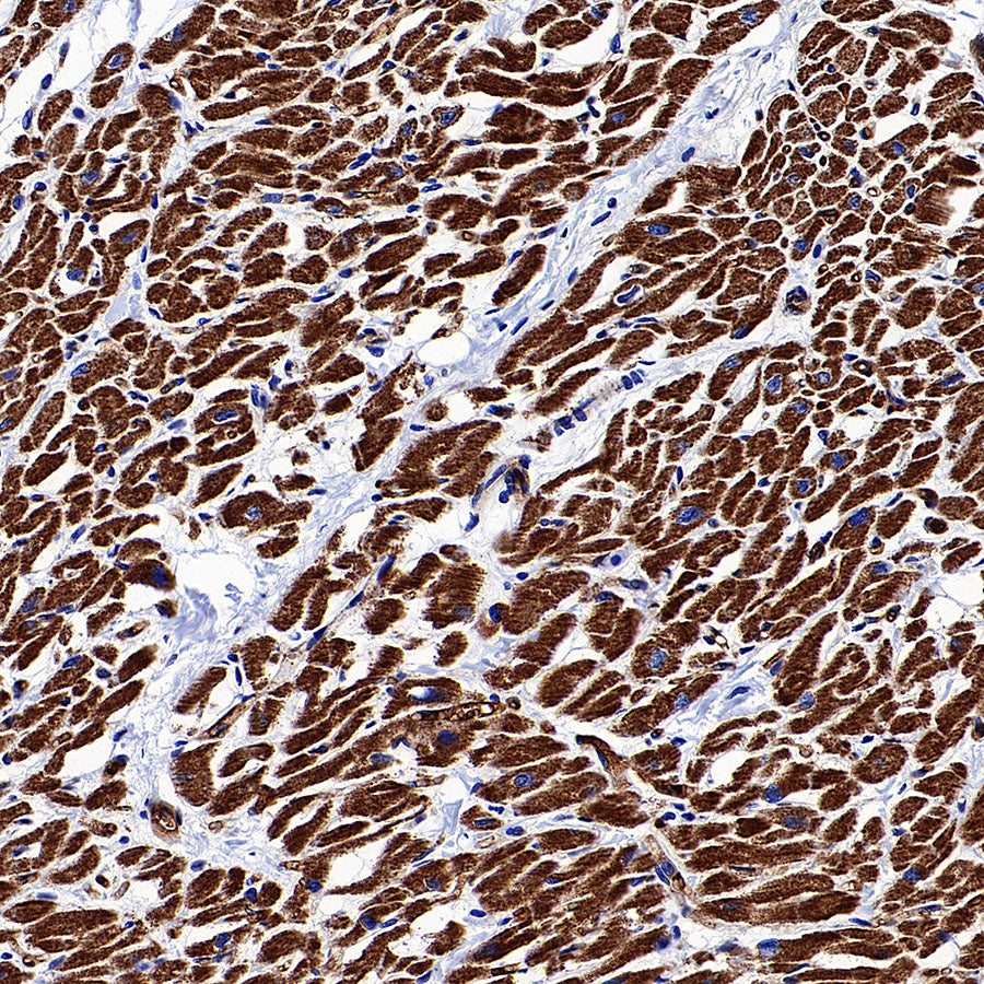 NDUFB8 Recombinant Rabbit mAb (S-4770-29)