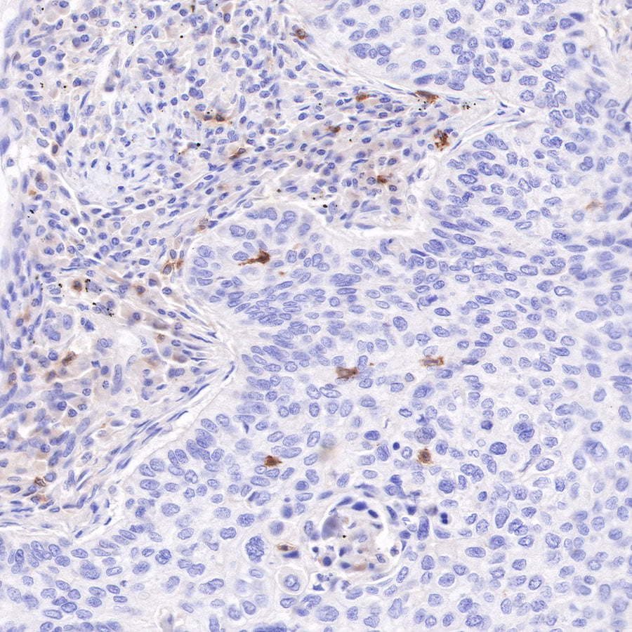CD103 Recombinant Rabbit mAb (SDT-R134)
