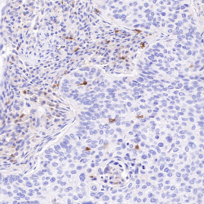 CD103 Recombinant Rabbit mAb (SDT-R134)