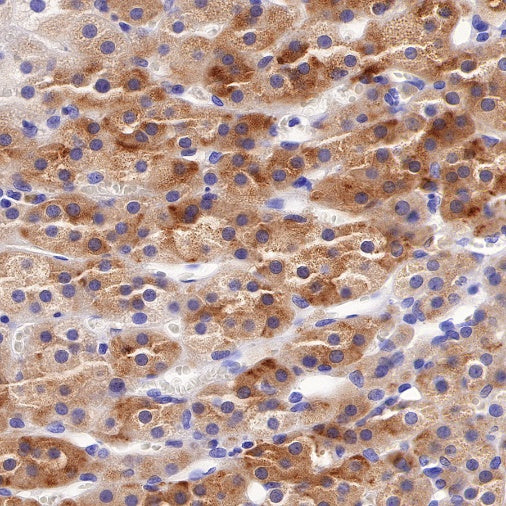 ACSL4/FACL4 Recombinant Rabbit mAb (S-461-6)