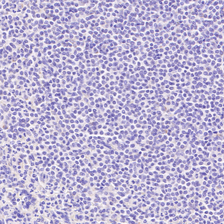 AMACR/p504s Recombinant Rabbit mAb (SDT-401-29)