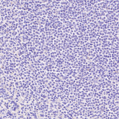 AMACR/p504s Recombinant Rabbit mAb (SDT-401-29)