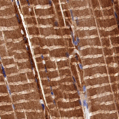 NDUFA1 Recombinant Rabbit mAb (S-1277-177)