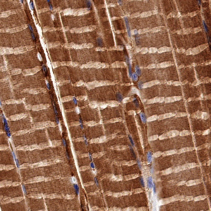 NDUFA1 Recombinant Rabbit mAb (S-1277-177)