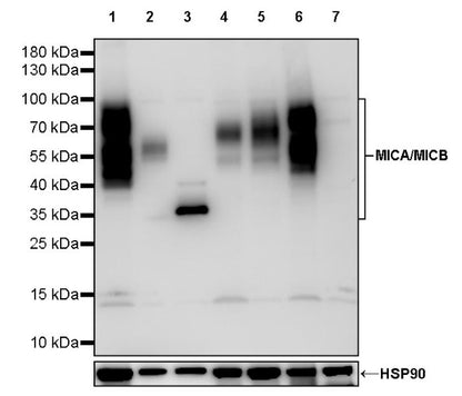 MICA/MICB Recombinant Rabbit mAb (S-1589-10)