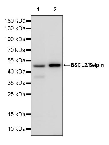 BSCL2/Seipin Recombinant Rabbit mAb (S-1669-46)