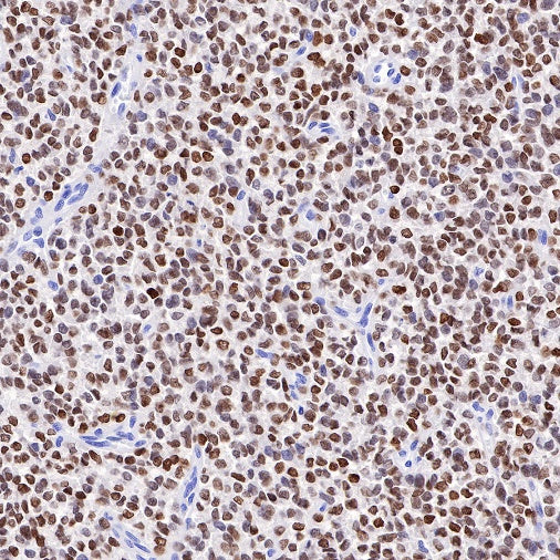 NKX2.2 Recombinant Rabbit mAb (SDT-898-41)