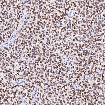 NKX2.2 Recombinant Rabbit mAb (SDT-898-41)