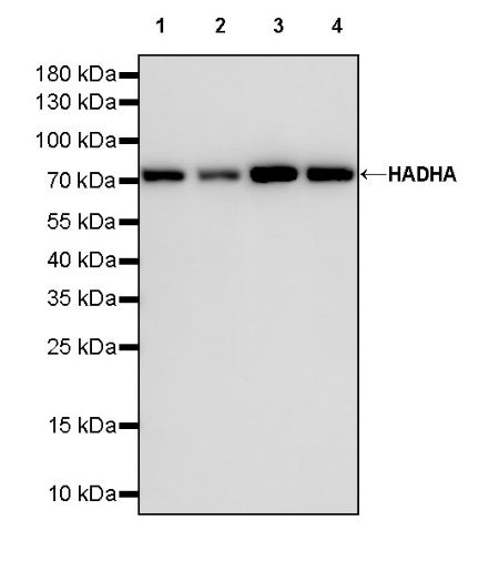 HADHA Recombinant Rabbit mAb (S-2345-8)