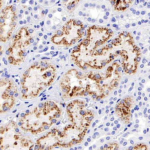 LAMP1 Recombinant Rabbit mAb (S-952-18)