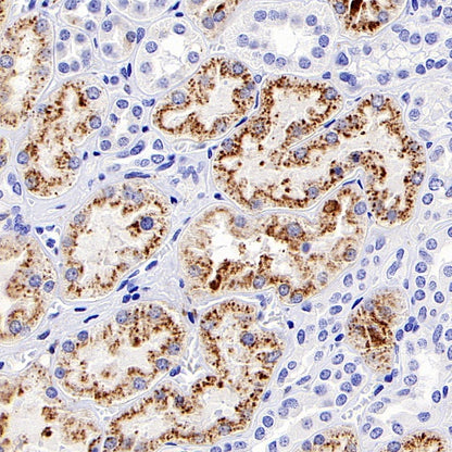 LAMP1 Recombinant Rabbit mAb (S-952-18)